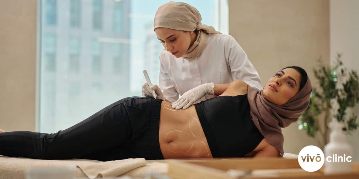 Practitioner in modest attire using white cosmetic marking lines to map flank treatment zones on a Middle Eastern woman at VIVO Clinic Dubai, with no device or handpiece in frame