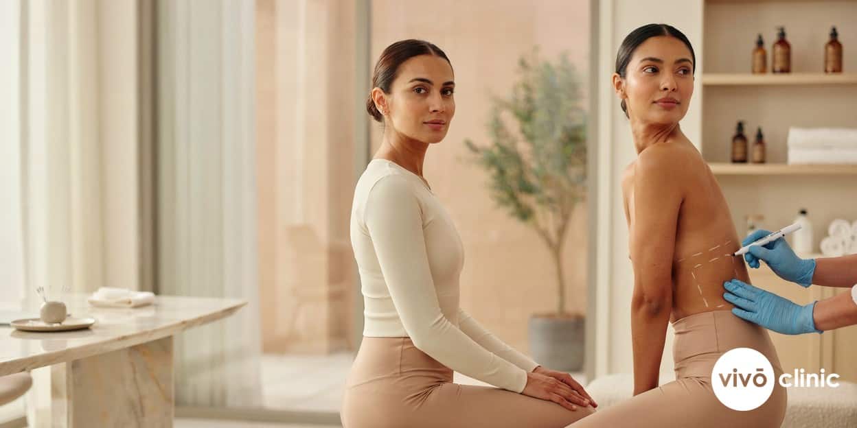Middle Eastern woman in modest activewear with white cosmetic marking lines drawn across her flanks during an Aqualyx love-handle consultation at VIVO Clinic Dubai
