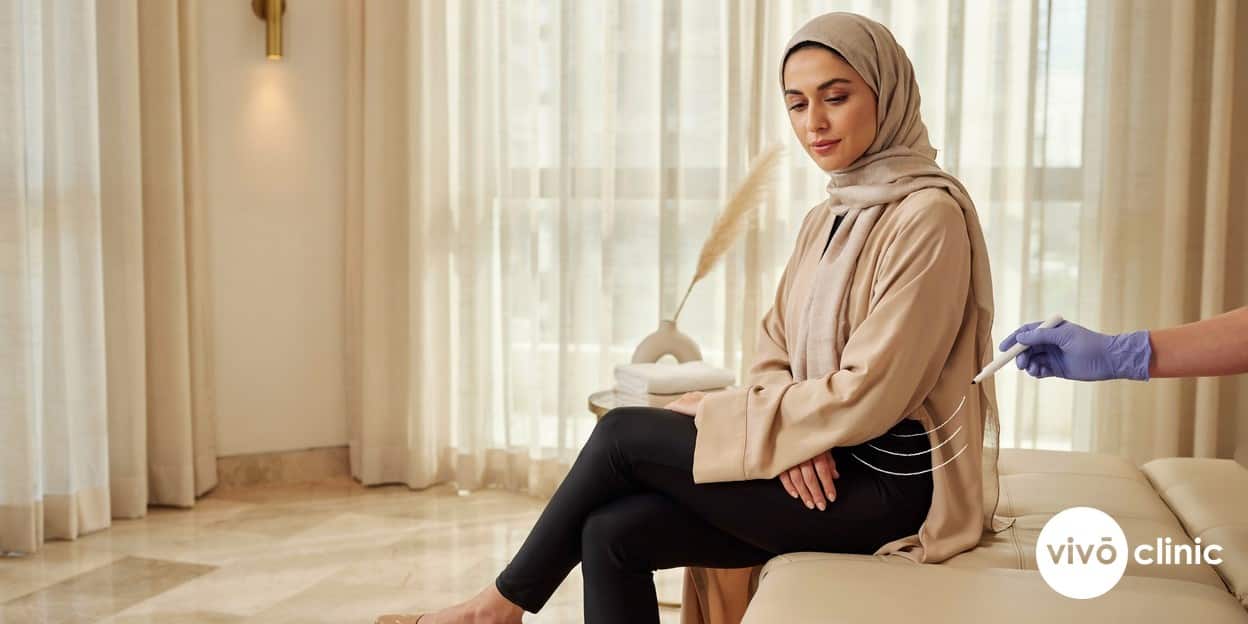 Middle Eastern woman in modest dress with white cosmetic marking lines drawn on her flank during a fat freezing consultation at VIVO Clinic Dubai, weighing cryolipolysis against liposuction