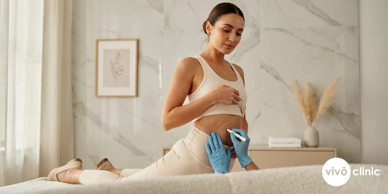 Middle Eastern woman in modest activewear with white cosmetic mapping lines on her abdomen during a body contouring programme consultation at VIVO Clinic Dubai