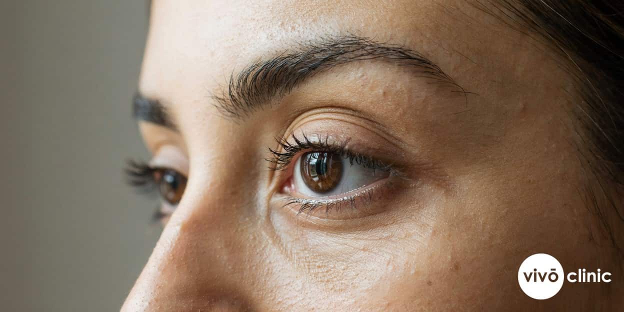 Photorealistic close-up of a Middle Eastern woman’s outer eye area showing fine crow’s feet lines, with the surrounding skin in soft natural light, illustrating periorbital ageing