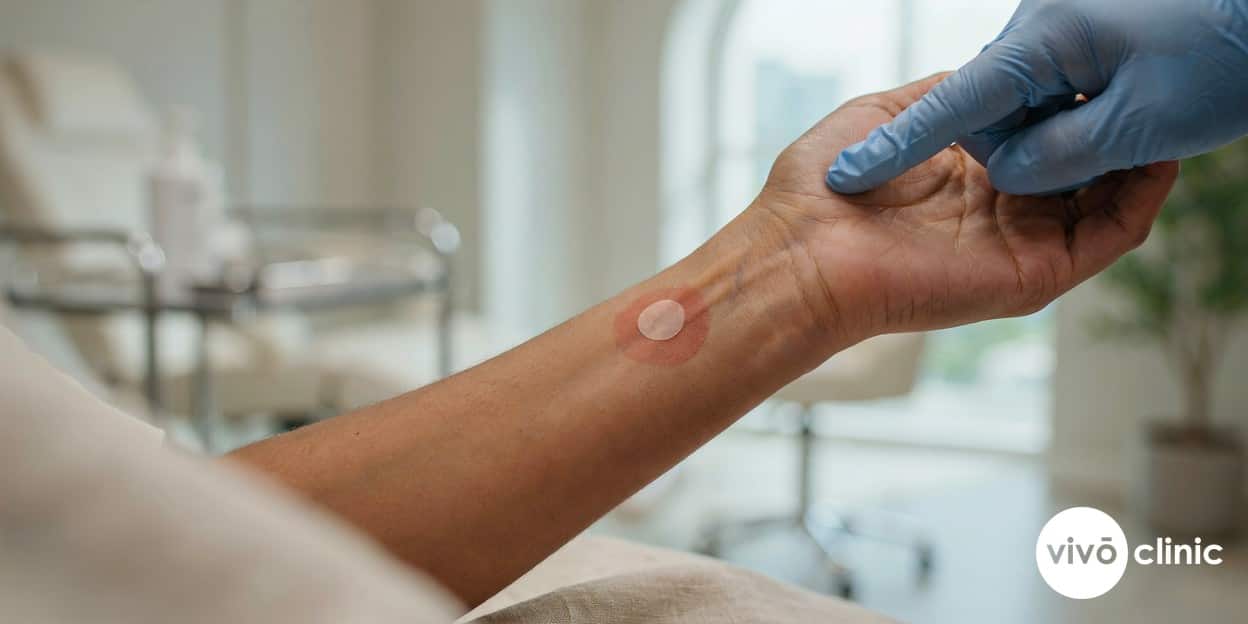 Close-up of a small plasma eye lift patch test mark on a Middle Eastern woman’s forearm being assessed for skin reaction before treatment